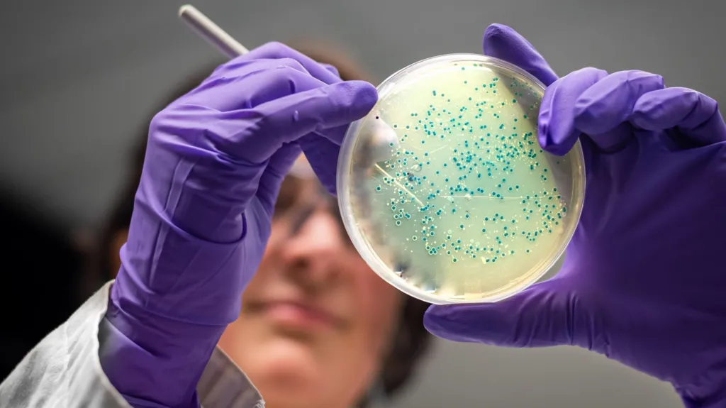 A.I.-ul Generativ a creat două antibiotice. Acestea sunt eficiente în uciderea bacteriilor rezistente la medicamente precum gonoreea și MRSA