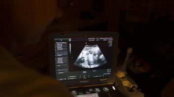 La Orchid Health, părinții pot alege embrioni după inteligență, înălțime sau riscuri de boli. Cât costă o astfel de procedură