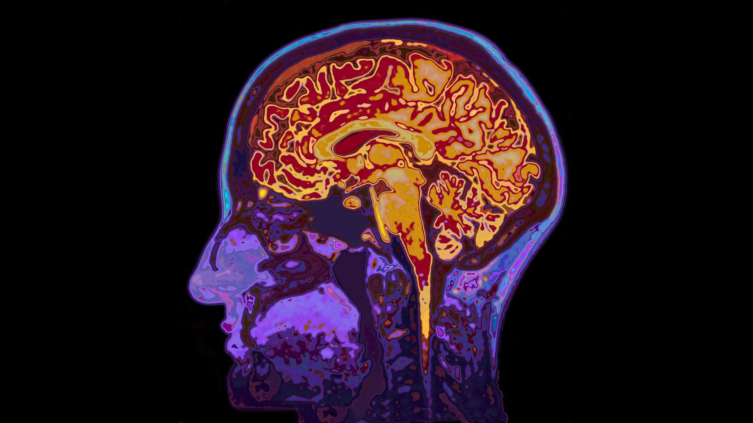 Creierul îți e o hartă exactă a trăirilor. Cercetătorii au descoperit prima semnătură cerebrală a intensității emoțiilor