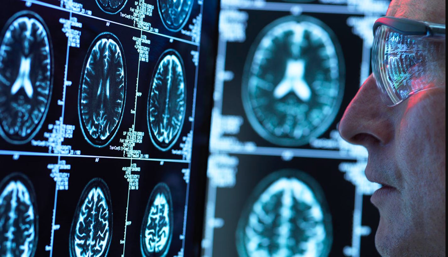 Cercetătorii de la Harvard au descoperit că LITIUL poate proteja creierul de îmbătrânirea cauzată de Alzheimer