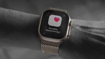 Apple lansează pe Apple Watch o funcție bazată pe A.I. care îți trimite notificări cu starea tensiunii tale arteriale