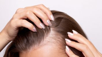 Coreea de Sud cere guvernului includă în asigurările de sănătate și tratamentele pentru căderea părului