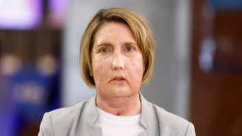 Premieră mondială în Medicină. Un spital din Spania a realizat primul transplant facial din lume. Felix Damian, editor corespondent Aleph News în Spania: „Intervenția este unică deoarece folosește, pentru prima dată, o donare facială de la o persoană eutanasiată”