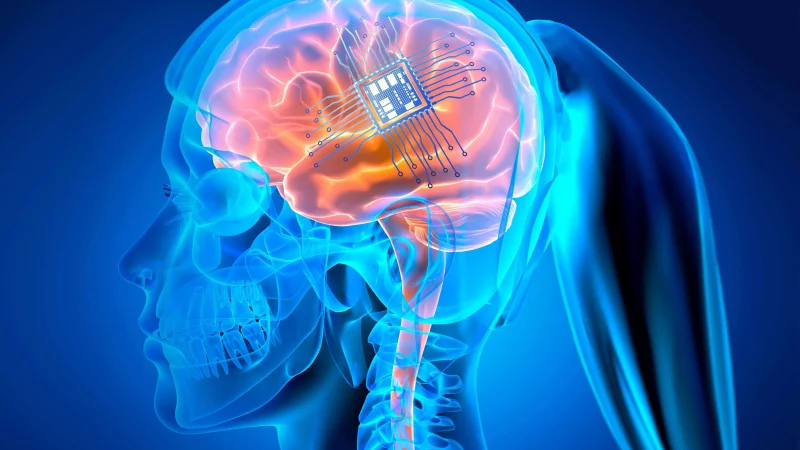 Implant