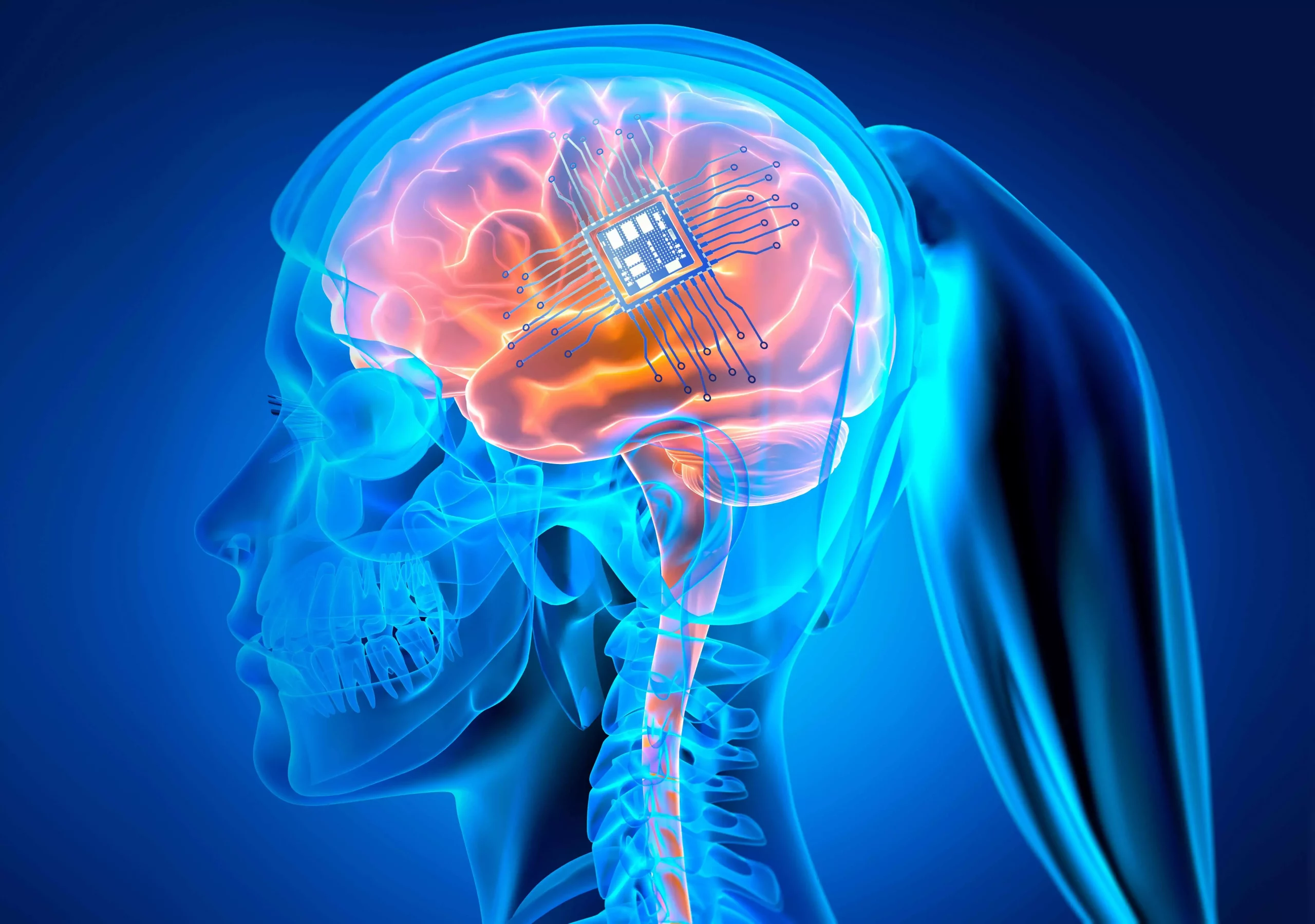 Paradromics, rivalul companiei Neuralink a lui Musk, a implantat cu succes primul cip în creierul unei paciente paralizate. Implantul promite redarea vorbirii